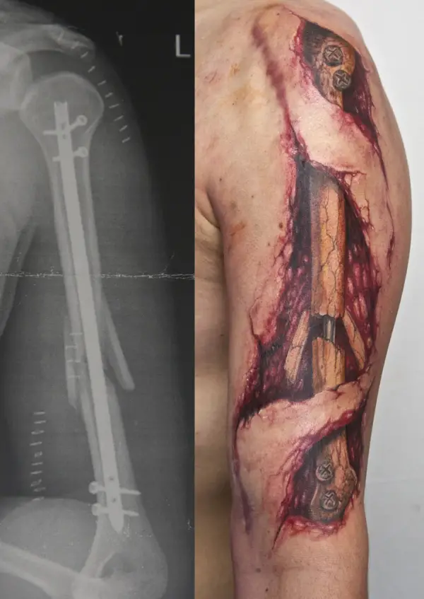 Broken Arm Tattoo