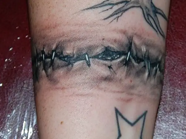 Stitched Skin Tattoo