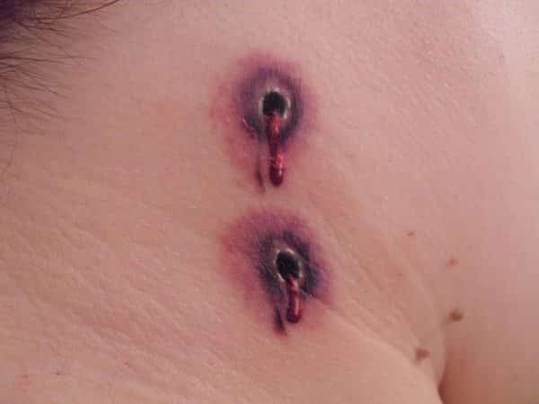 Purple and Black Vampire Bite with Bruising and Blood