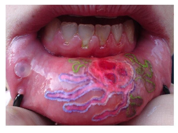 Colored Jellyfish Inner Lip Tattoo
