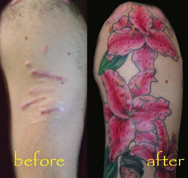tattoo to cover self-injury scar