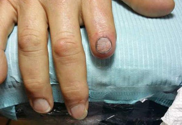 finger tattoos