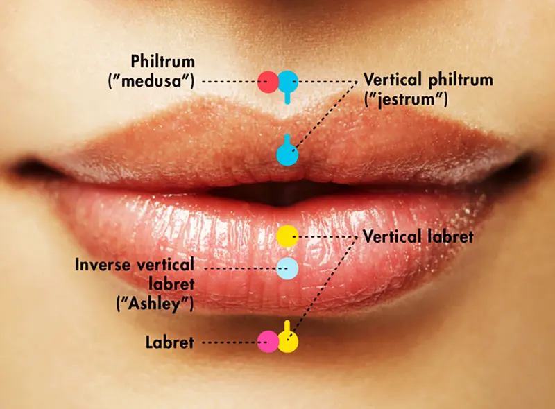 What is a Philtrum Piercing?